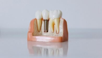 hungary dental implants services