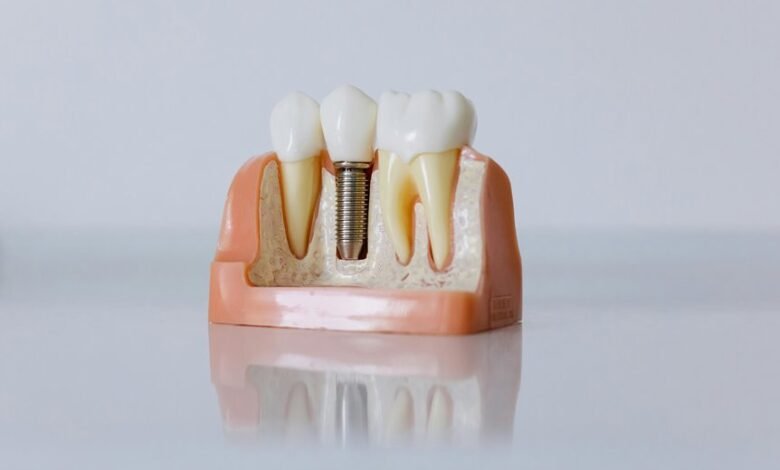 hungary dental implants services
